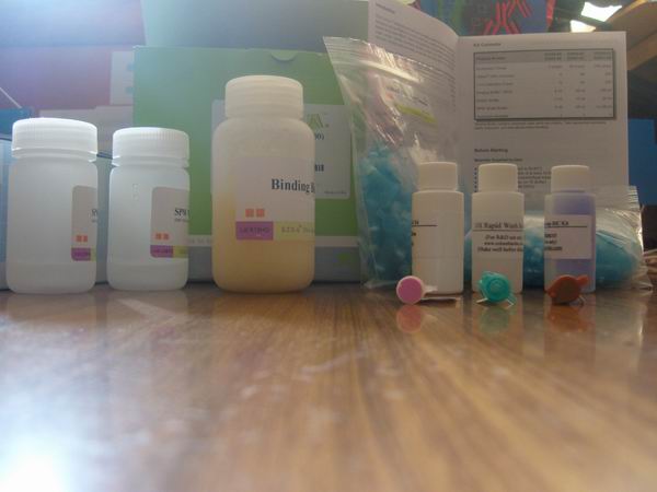 人半胱氨酸蛋白酶抑制剂SNelisa试剂盒&nbsp;&nbsp;ELISA试剂盒