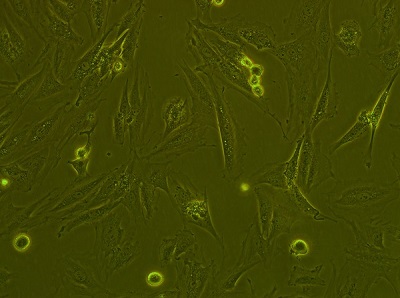 （FTC-133）甲状腺癌细胞