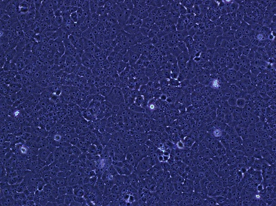 （FTC-133）甲状腺癌细胞