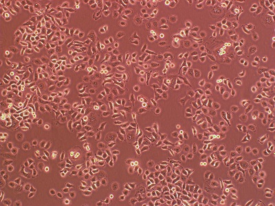 （FTC-133）甲状腺癌细胞
