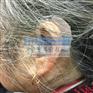 上海西门子南汇助听器上门服务,清明打折啥都便宜