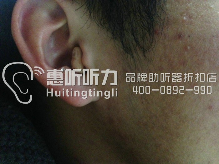 广州越秀区瑞声达米格助听器优惠促销&nbsp;&nbsp;瑞声达助听器&nbsp;&nbsp;瑞声达品牌助听器