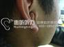 上海卢湾区瑞声达心意助听器限时特惠