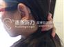 上海奥迪康新飞翔助听器超低特价来袭
