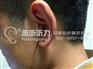 上海闸北西门子萨克斯助听器限时抢购