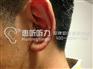 上海杨浦西门子新音乐助听器保证最 低价