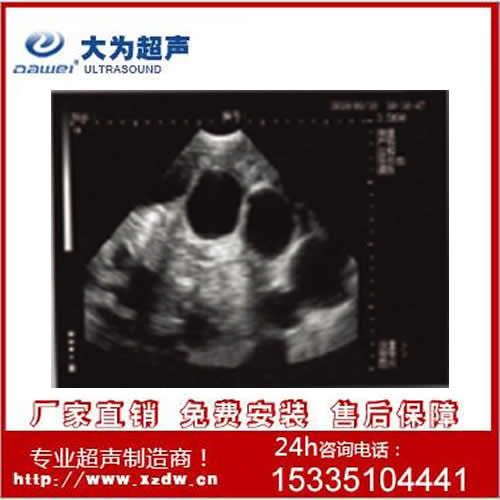 笔记本B超仪动物B超 兽用便携式超声