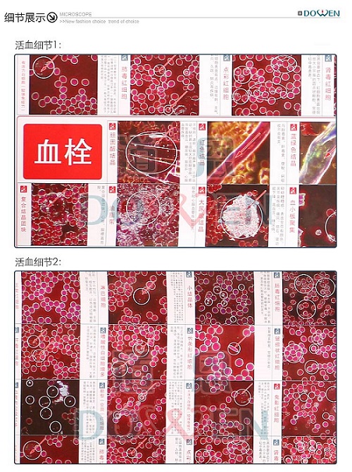 道恩黑背景305一滴血检测仪 挂图 小图 血液对比图  耗材