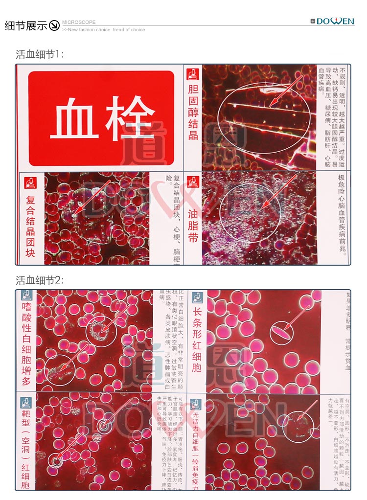 道恩黑背景305一滴血检测仪专用 挂图 大图 干活血对比图  耗材