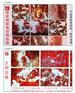 道恩黑背景305一滴血检测仪专用 挂图 大图 干活血对比图