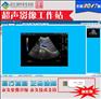 超声影像工作站