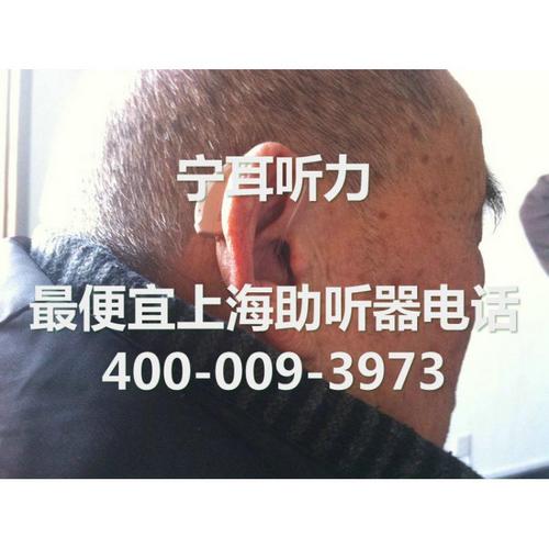 上海斯达克爱丽丝Aries助听器5.1放假助听器打折  斯达克助听器  51放假