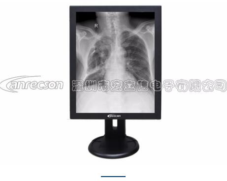 2MP高清灰阶医用显示器|安立信灰阶医用显示器  灰阶显示器