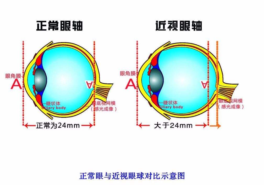 加乐美视力矫正训练系统，还我们一双明亮的双眼