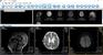 供应索源科技PACS系统RIS系统