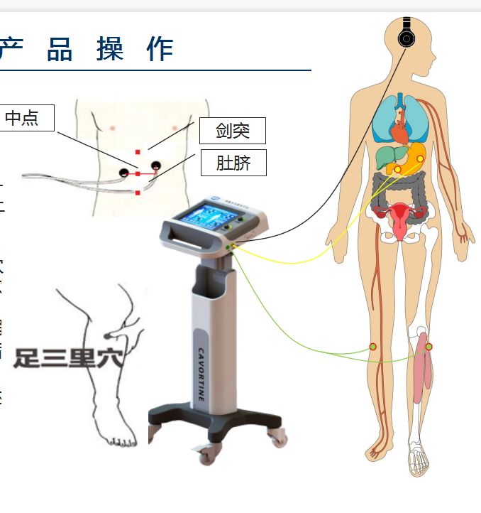 胃肠多功能治疗仪项目推荐书  胃肠治疗仪  数字化音乐胃肠治疗仪