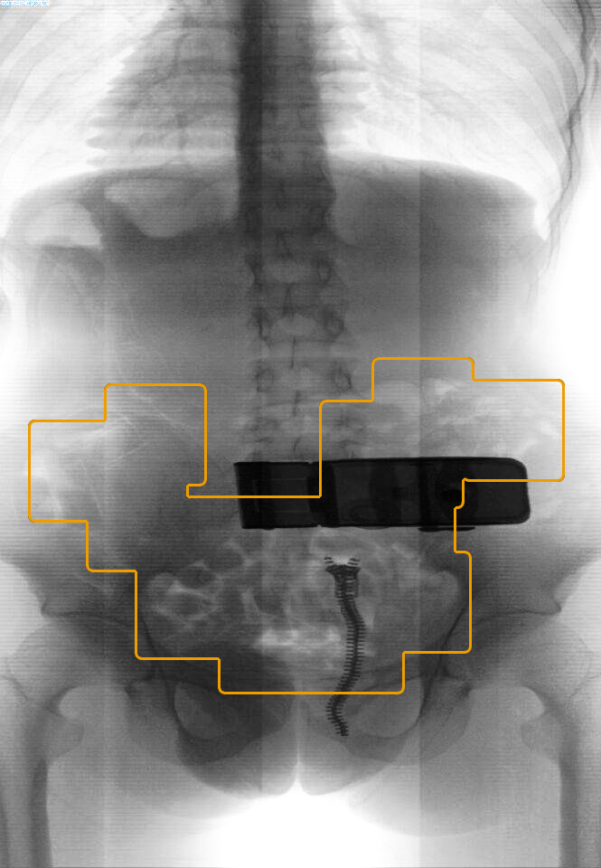 启路达供应腹部携带物检测安检仪  人体安检机  腹部安检仪  安检机器人