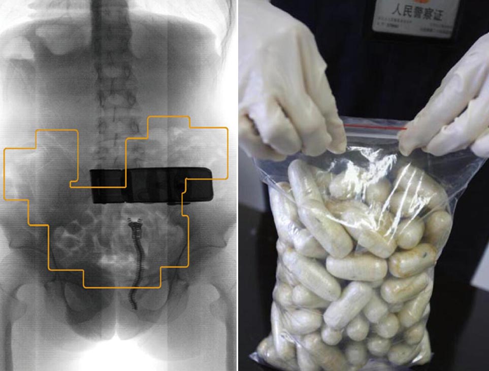 启路达供应腹部携带物检测安检仪  人体安检机  腹部安检仪  安检机器人