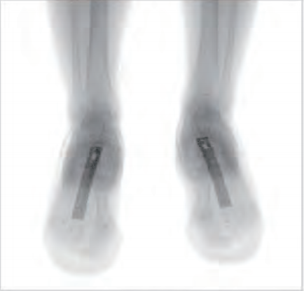 启路达供应足部足底人体局部安检仪  人体安检机  足部安检机  足部安检仪