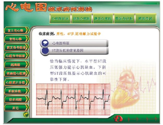 益联医学新版心电图教学软件 心电图临床实例解读&nbsp;&nbsp;心电图案例解析