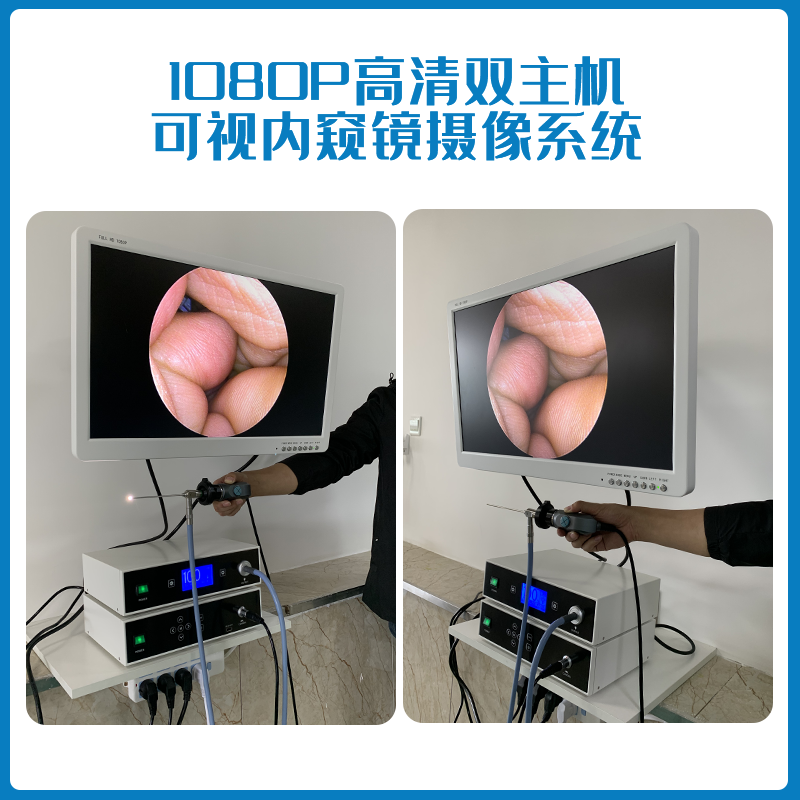 双主机可视内窥镜仪器 YG-2303 24寸屏幕  主机款可视采耳仪器  可视采耳仪器有几种  高清可视采耳设备