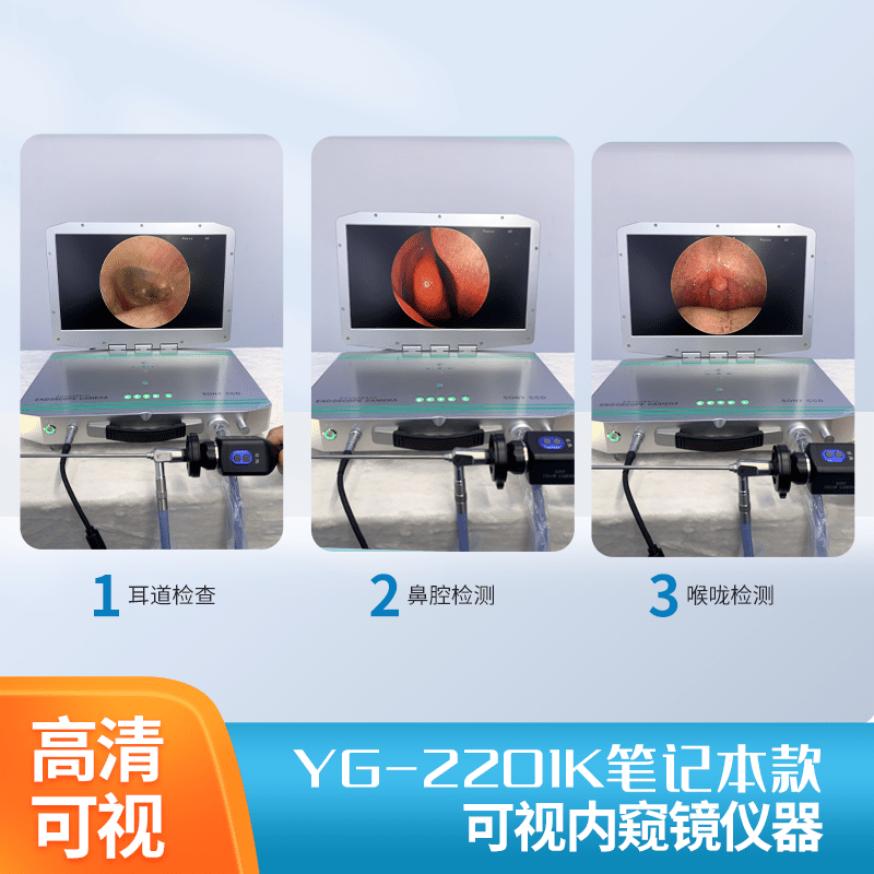 医用标清笔记本摄像加冷光源一体机可视采耳仪器  采耳仪器厂家排名  采耳仪器设备价格  采耳仪器挂壁式